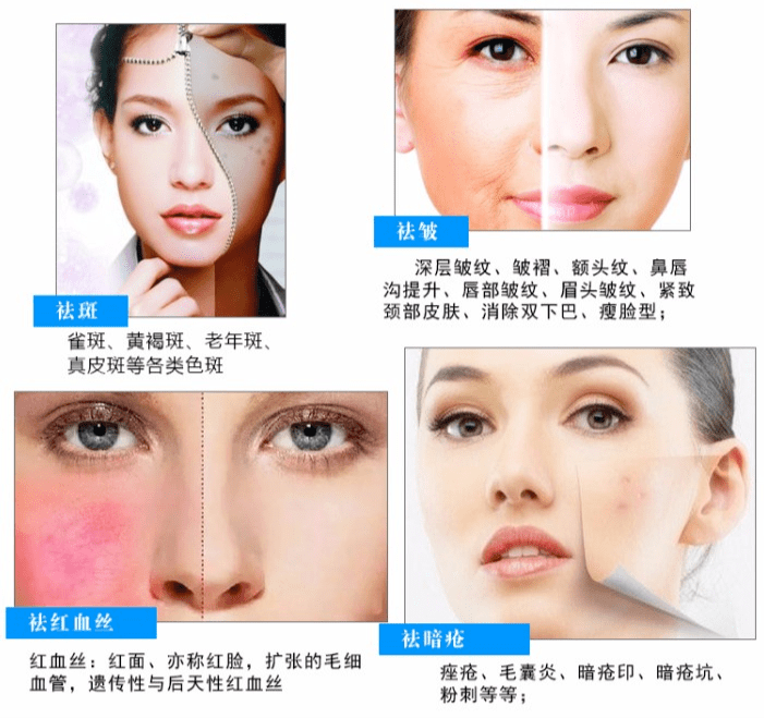 皮肤|爱兰诗 | 痘印色斑衰老接踵而至？一招轻松摆脱黄脸困扰！
