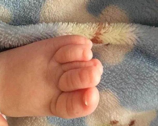 几个月宝宝会出现搓脚 343d215ce00347bcb9bfe08be69d23f3.jpeg