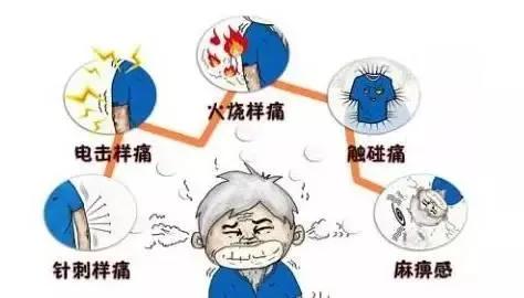 天下|号称“天下第一痛”的三叉神经痛究竟有多痛？答案在这里！