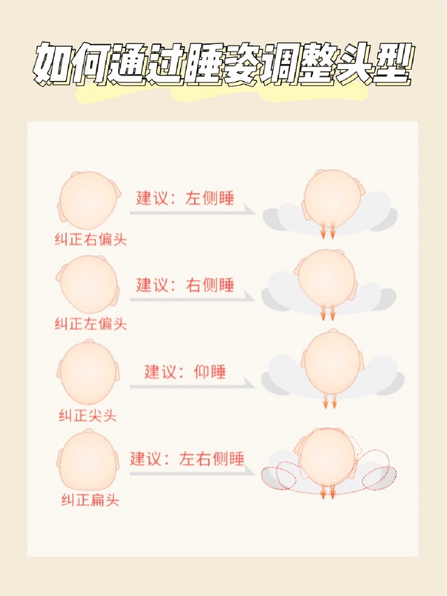 状头|如何成功睡出小圆头？舟状头的逆袭之路！