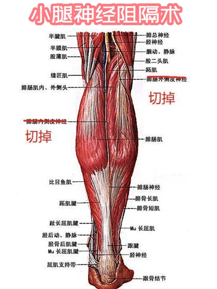 小腿脂肪分布图片