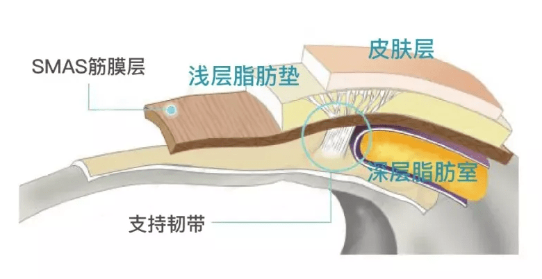 皮肤|线雕哪个牌子最好？菲翎线国内首款获NMPA械三认证的面部锥体提拉线