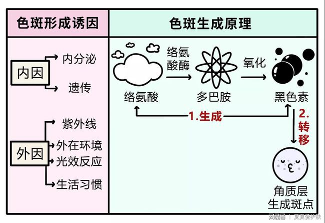 雀斑|色素斑点如何高效解决？圣秋波给你答案