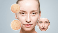 肤质|干皮如何在炎炎夏日保养护肤？