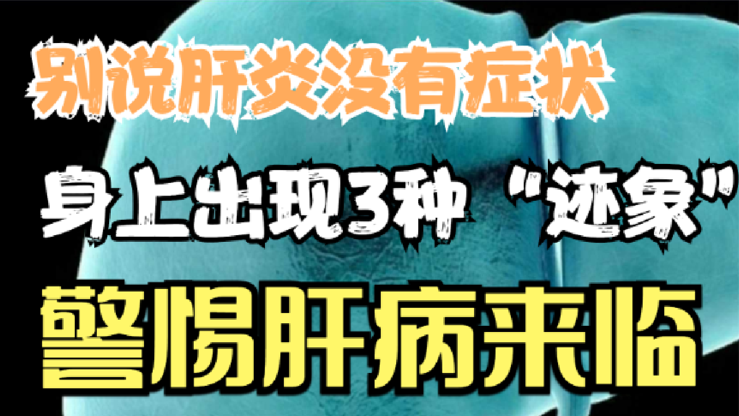 別說肝炎沒有症狀身上出現3種跡象警惕肝病來臨