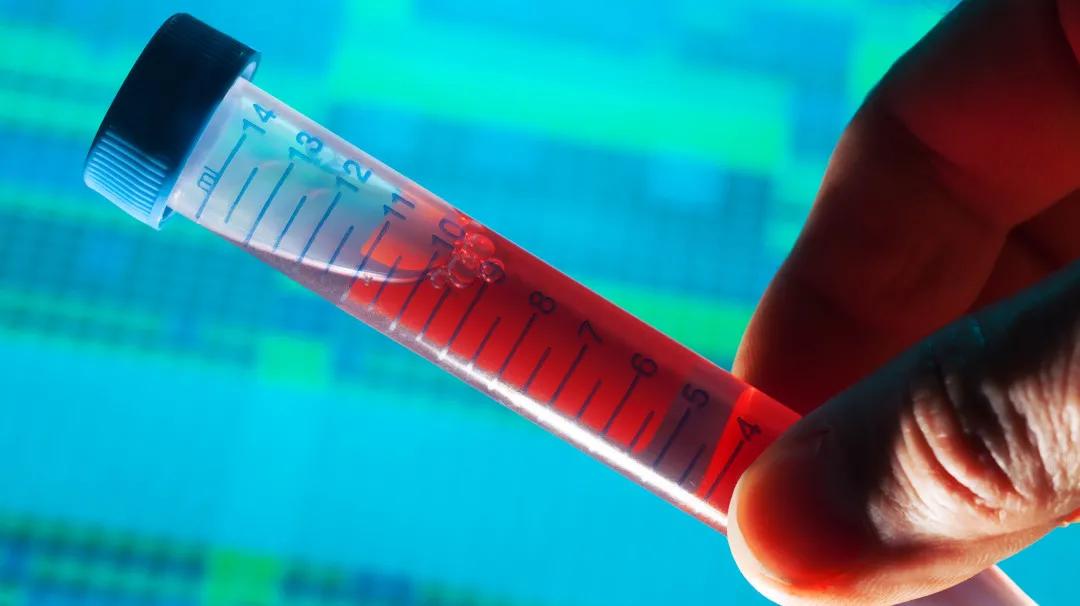 甲状腺|国康健康管家:体检报告中这些高异常指标,不用找医生,也能看懂了!