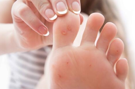 症状|糖尿病患者出现这些表现，说明血糖要失控了，不能忽视