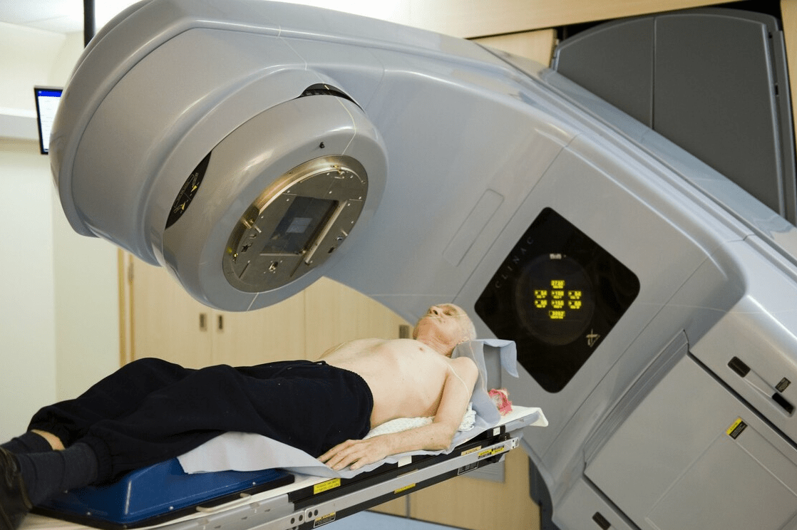 立体定向放射治疗和普通放疗有哪些区别放疗的多种类型哪个最好用