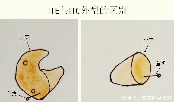 最新款式助听器 3b448fa9c0204259ae5da175425790d1.jpeg