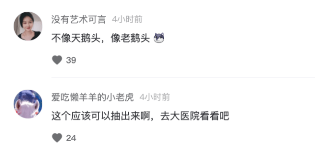 小冉|整容有风险！女网红额头填充成“天鹅头”形状，自称变成畸形，一脸生不如死