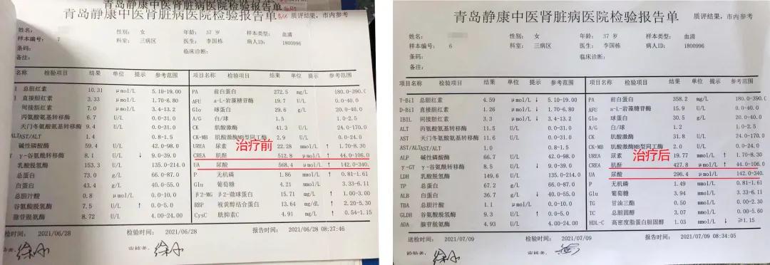 尿酸|一念之差，让所有治病努力功亏一篑