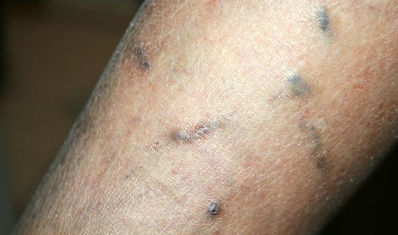 吃什么预防血管炎症 80e118cc4eb14c3b95bbd4162acb6bd8.jpeg