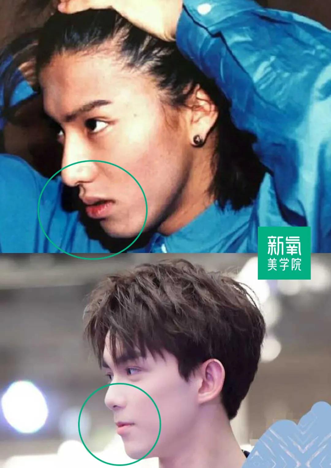 所以虽然吴磊的鼻基底并不低,但因为嘴凸,和薄唇,他的面中竟显得相对