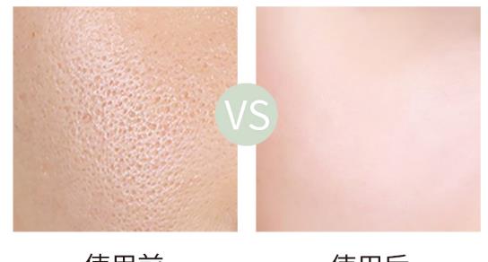 青春痘|裴秀智不愧是“国民初恋”，如此近照都看不到毛孔，这脸看着羡慕