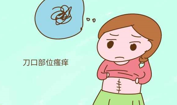 时间|“我躲过了顺产的疼痛，却栽倒在剖腹产的恢复上”你也是吗？