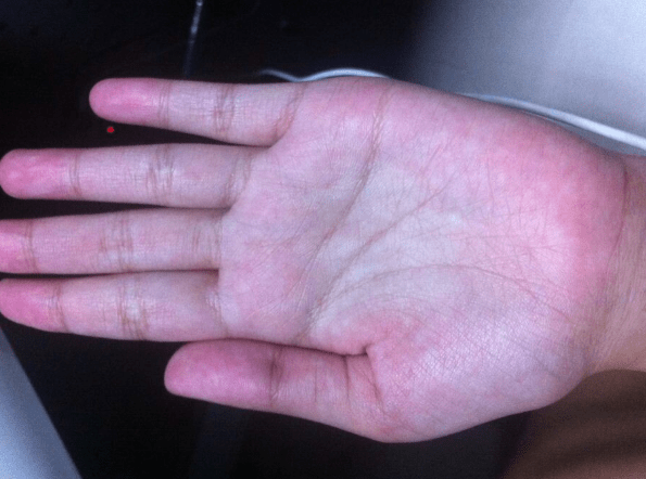 症状|怎么判断自己肝脏是否健康?中医:这还不简单,7个方法拿好不送