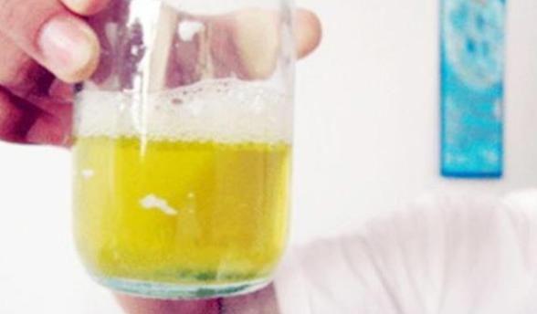 严重|“肝脏”疾病日益增多,身体会用哪几种方式提醒你?早知道早预防