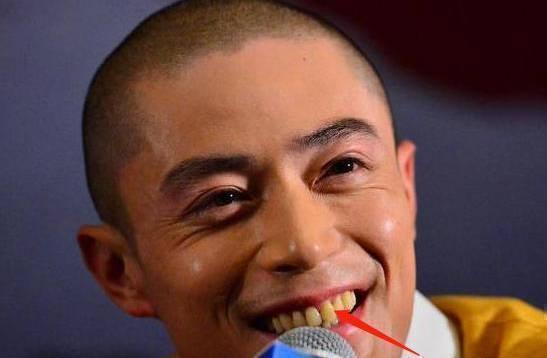 形象|屈臣氏有款被“埋没”的牙膏，高质价低，能去黄除垢、清新口气