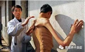 是一种|肌营养不良到底是一种什么样的疾病？