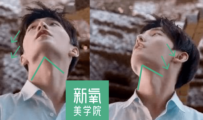 眉骨|给赵露思换了天使大宝贝的眉骨和眼眶骨，这张脸洋气指数飙升120%