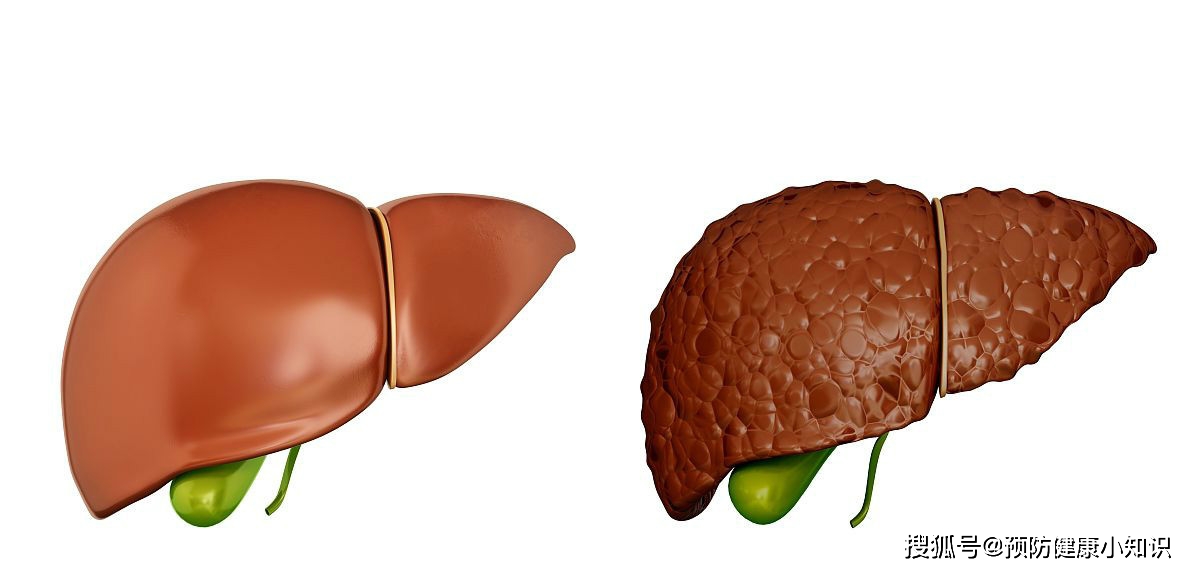 眼睛|有乙肝的人群，身体发出四种信号的时候，一定要小心肝癌！