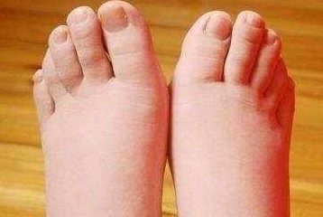 肾脏|身体出现8种症状别大意，可能是肾脏发出的报警信号