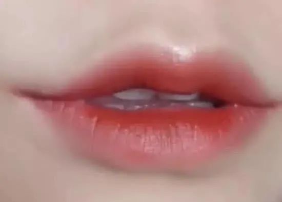 调整|嘟嘟唇、水光唇，告别盲目跟风，唇部可做医美大合集~