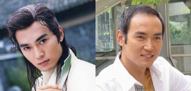 假发|不只是黄晓明，半个娱乐圈都“秃”了，连00后都跟假发片较上劲了