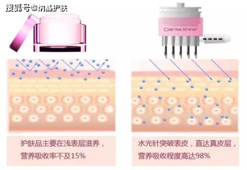 体细胞|补水效果胜过N张面膜，水光真有这么好吗？