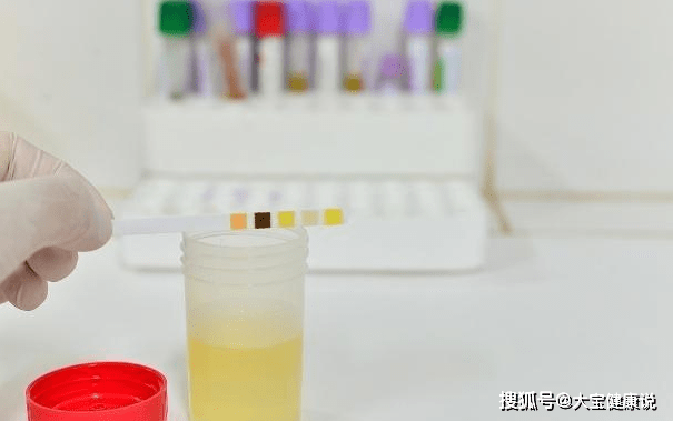 肾脏|糖尿病患者，排尿时有一些变化，可能是尿毒症的早期征兆！