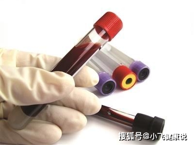 时间|餐前血糖4.5正常吗?他却因此而被诊出糖尿病,诊断标准是多少?