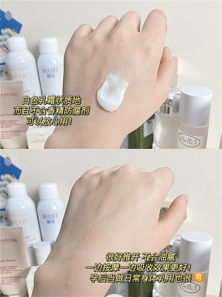 体重|不想长妊娠纹？坚持做对4件事，妊娠纹都会绕着你走！医生都夸好