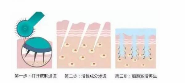 疗法|伊肤泉祛痘以硬核实力全新亮相，问题肌研究所一体化解决泛痘肌