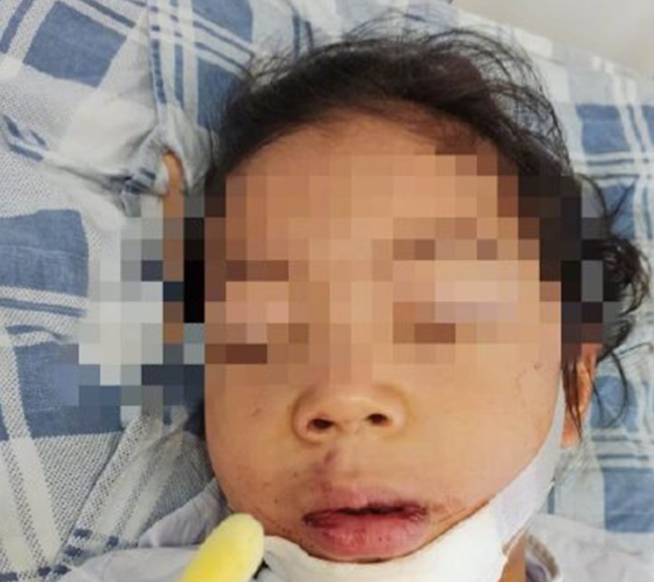 家长|女童午饭吃得少，幼儿园老师将其留在教室反思，随后女童坠落一楼