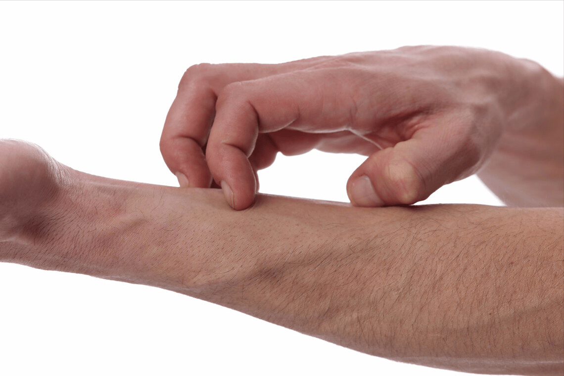 皮肤|路边一种常见野菜专治湿疹，用水一煮即可变成湿疹克星