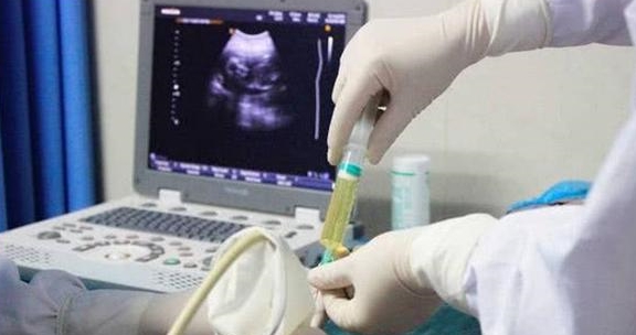 什么时候检测怀没怀孕 0052c2674aaf422ca99641f5dd3d0ac7.jpeg