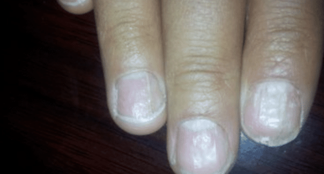 肝脏|肝脏好不好，竖起拇指就知道！若没有3个“异常”，肝脏还算干净