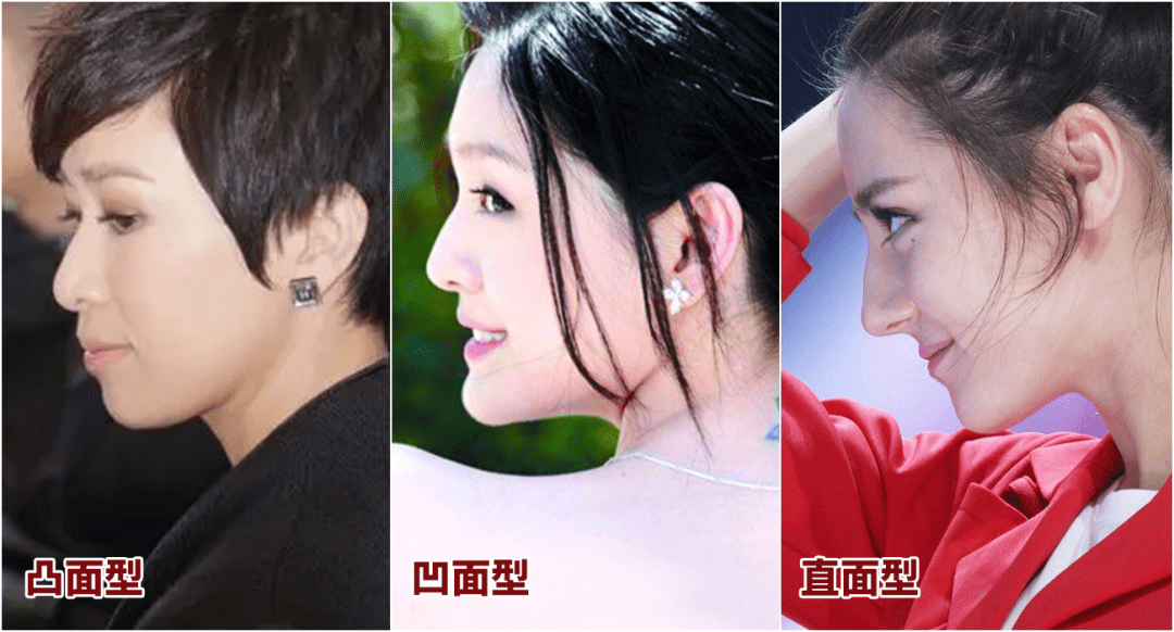 眼睛|什么样的长相特点会显“土味”？女明星都是怎样悄悄变精致的？