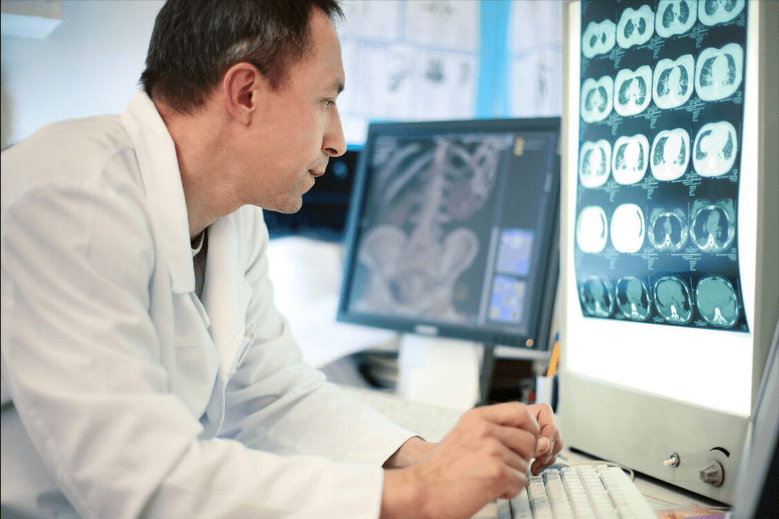 男子|43岁男子服用西地那非后脑出血，医生：提前了解这3个问题很重要