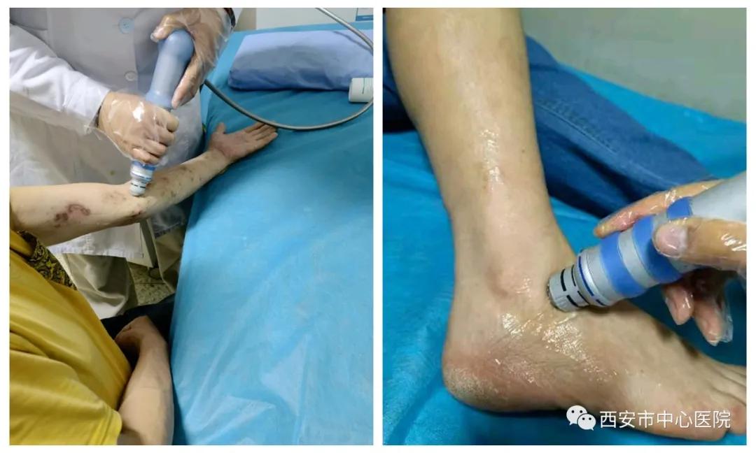 病房|西安市中心医院疼痛科——全新住院病房正式投入使用