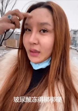 因为|女网红注射奥美定8年后爆发问题，额头内部溃烂，透露胸和屁股都曾注射奥美定