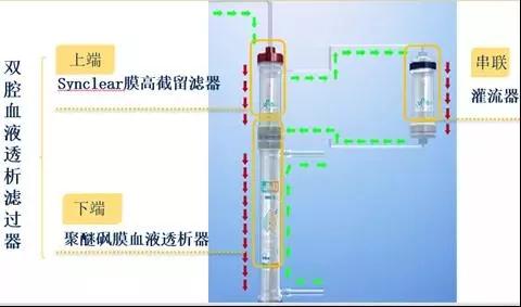 治疗|陕西首例|西安医学院一附院开展第三代血液净化新技术“血滤吸附SupraHFR”