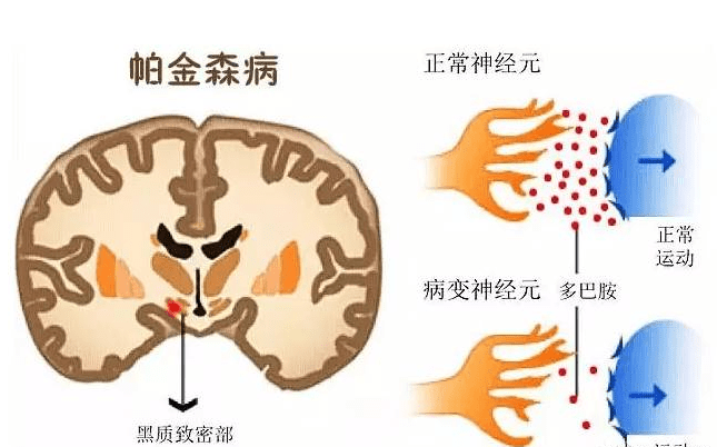 副作用|芝麻素——帮助缓解神经炎症