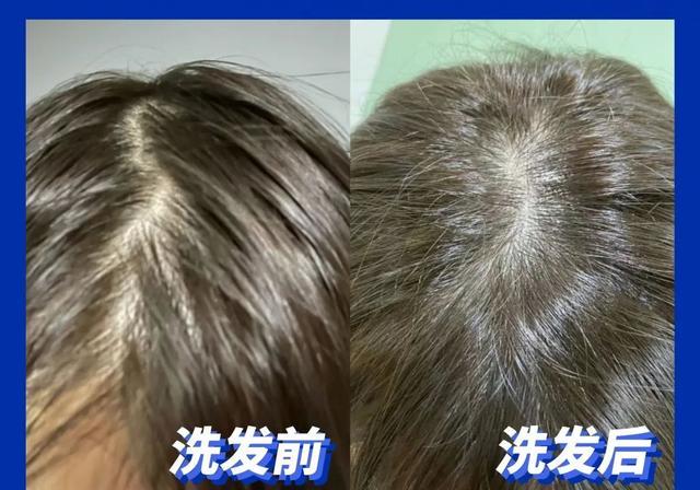 头皮|超难用的洗发水避雷，你中招了吗？