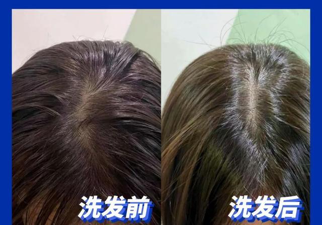 头皮|超难用的洗发水避雷，你中招了吗？