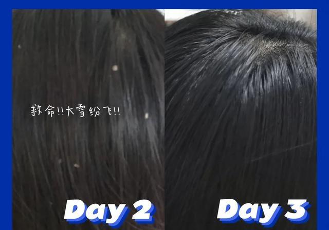 头皮|超难用的洗发水避雷,你中招了吗?