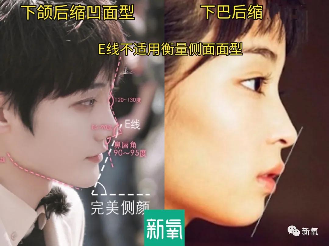 平面|作为被力捧多次的古偶女主，侧颜却被男主吊打的还第一次见