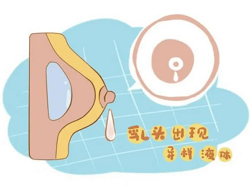 乳房|铭医严选：先了解，后治疗，不要被乳腺癌吓到了
