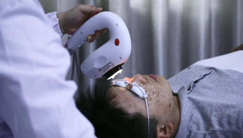 用强脉冲光ipl治疗干眼会疼吗图文讲解全过程