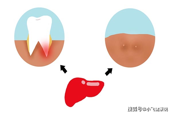 疫苗|和确诊乙肝的人一起吃饭，会被传染吗？如何预防乙肝病毒？